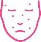 Aparición de manchas y lentigos